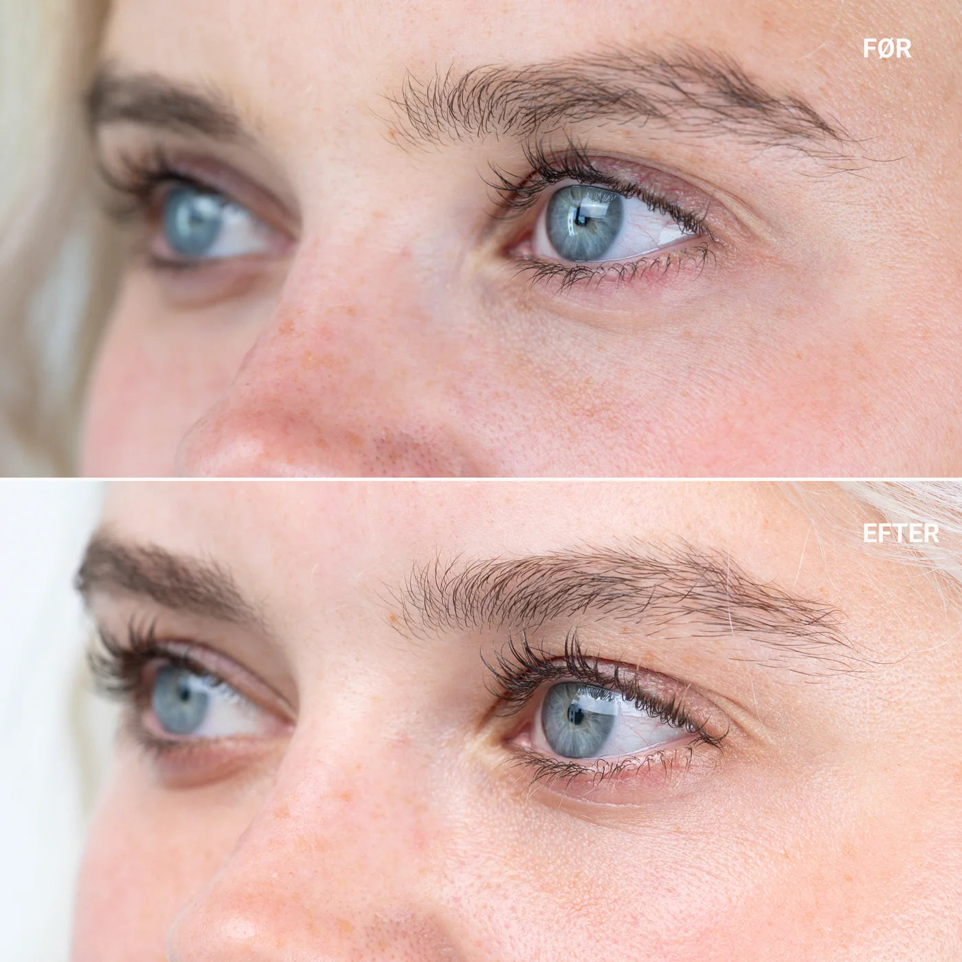 SANZI BEAUTY EYE ZONE CONDITIONER SERUM Salgspris